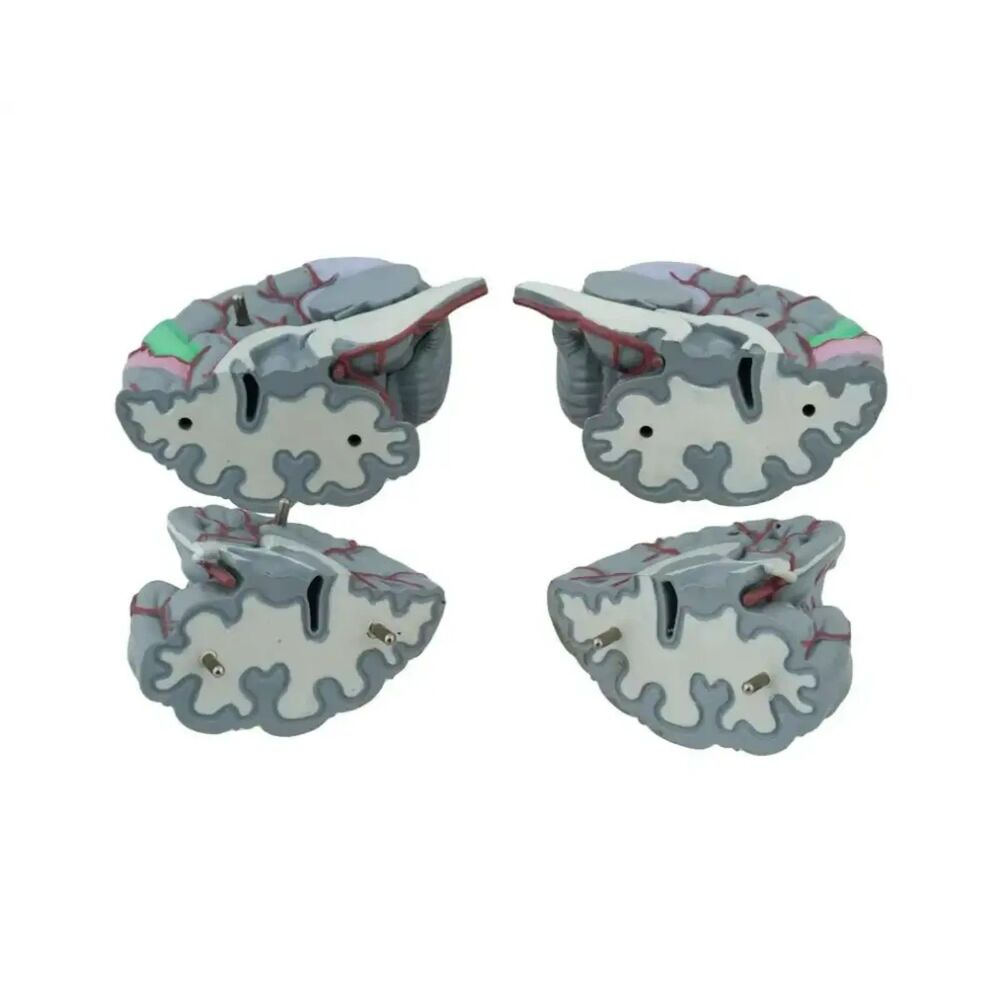 Life Size Human Brain Model - Medical Teaching (w/ 4 sections) EUC - Picture 7 of 10